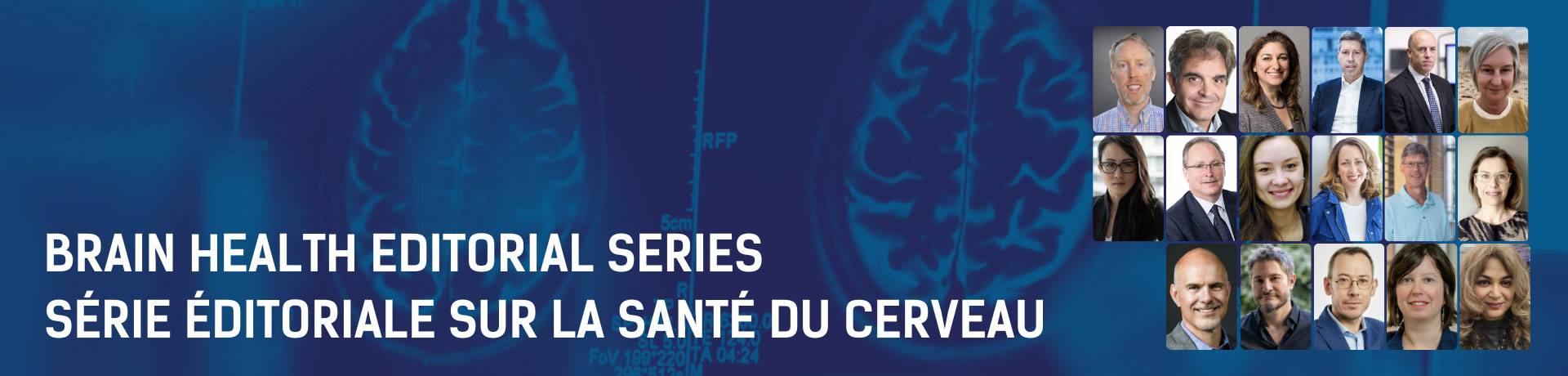 Brain-Health-Editorial-Series-Bilingual Banner